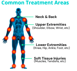 pictured is a diagram of areas of the human body where StemWave can treat