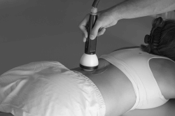 pictured is a StemWave device being used on a lower back